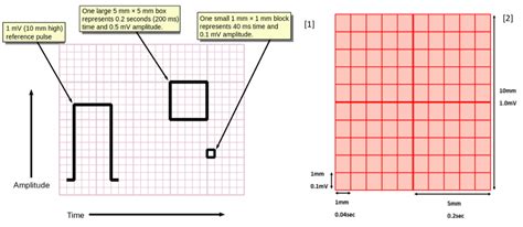 How Many Small Squares Are in a Large Square on ECG Tracing Paper? And Why Does It Feel Like Counting Stars?